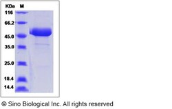 Sino Biological Human Frizzled-10 / FZD10 Protein (Fc Tag) 100ug, Quantity: