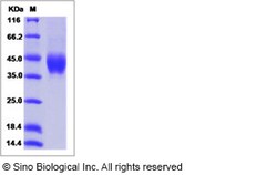 Sino Biological Human HEPACAM Protein (ECD, His Tag) 100ug, Quantity: Each