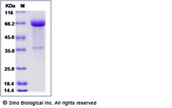 Sino Biological Recombinant Human KIR2DL5 Protein (hFc Tag), Quantity: