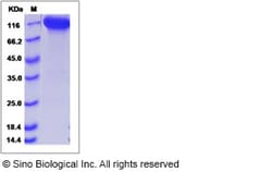 Sino Biological Recombinant Human NCAM2 Protein (hFc Tag), Quantity: Each