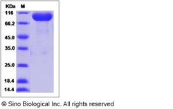 Sino Biological Recombinant Human NCAM2 Protein (His Tag), Quantity: Each