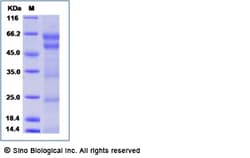 Sino Biological Human NPTXR Protein (His Tag) 50ug, Quantity: Each of 1