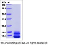 Sino Biological Recombinant Human Neuregulin-3/NRG3 Protein (His Tag),