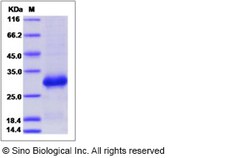 Sino Biological Recombinant Human RANK/TNFRSF11A Protein (His Tag), Quantity:
