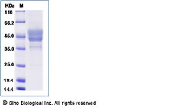 Sino Biological Human BAFFR / TNFRSF13C / CD268 Protein (Fc Tag) 50ug,