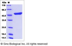 Sino Biological Recombinant Human APOA4 Protein (His Tag), Quantity: Each