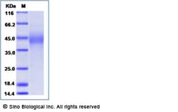 Sino Biological Human MILR1 / Allergin 1 Protein (His Tag) 100ug, Quantity: