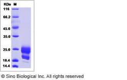 Sino Biological Recombinant Human CEACAM19 Protein (ECD, His Tag), Quantity: