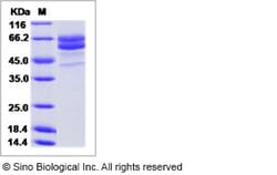 Sino Biological Recombinant Human FAM20C Protein (His Tag), Quantity: Each