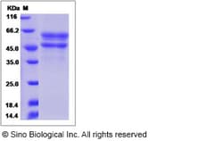 Sino Biological Recombinant Human IGFLR1 Protein (hFc Tag), Quantity: Each