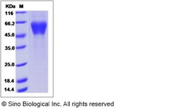 Sino Biological Human KREMEN1 Protein (His Tag) 50ug, Quantity: Each of