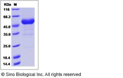 Sino Biological Recombinant Human RNF43 Protein (hFc Tag), HPLC-verified,
