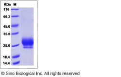 Sino Biological Recombinant Human RNF43 Protein (His Tag), HPLC-verified,