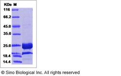 Sino Biological Human GH1 Protein (His Tag), Quantity: Each of 1