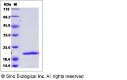 Sino Biological Human FGF8a / FGF-8a Protein 50ug, Quantity: Each of 1