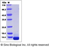 Sino Biological Recombinant Human COL6A3 Protein (His Tag), Quantity: Each