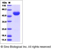 Sino Biological Recombinant Human Frizzled-4 Protein (hFc Tag), Quantity: