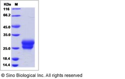 Sino Biological Recombinant Human Frizzled-4 Protein (His Tag), Quantity: