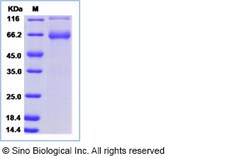 Sino Biological Recombinant Human ITIH3 Protein (hFc Tag), Quantity: Each