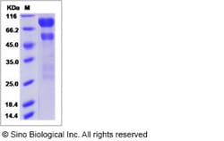 Sino Biological Human ITIH3 Protein (His Tag) 100ug, Quantity: Each of