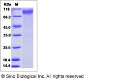 Sino Biological Human B7H7 / HHLA2 Protein (ECD, Fc Tag) 50ug, Quantity: