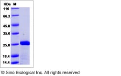 Sino Biological Recombinant Human MTH1 Protein (His Tag), Quantity: Each