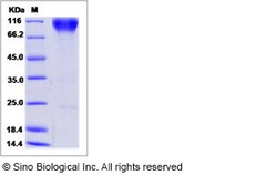 Sino Biological Recombinant Human FGFR2 Protein (alpha IIIb, hFc Tag),