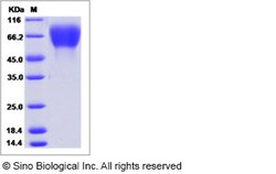 Sino Biological Recombinant Human FGFR2 Protein (ECD, His Tag), HPLC-verified,
