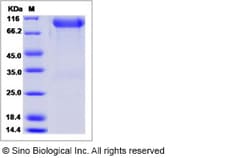 Sino Biological Human FGFR3 / CD333 Protein (alpha(IIIb), Fc Tag) 200ug,