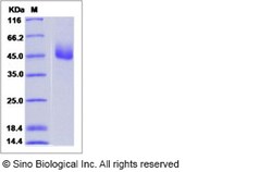 Sino Biological Recombinant Human TM2D1 Protein (mFc Tag), Quantity: Each