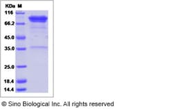 Sino Biological Recombinant Human LAG-3 Protein (ECD, mFc Tag), HPLC-verified,