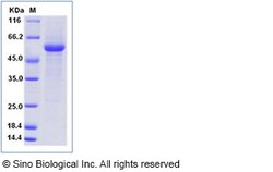 Sino Biological Human LAG3 / CD223 / Lymphocyte activation gene 3 Protein