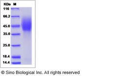 Sino Biological Human NPC1 Protein (His & FLAG Tag) 100ug, Quantity: Each