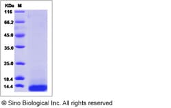 Sino Biological Human TFF3/Trefoil Factor 3 Protein (His Tag) 50ug, Quantity: