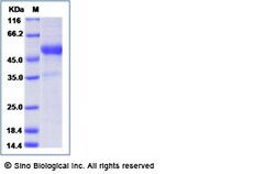 Sino Biological Human TL1A / TNFSF15 Protein (mFc Tag) 100ug, Quantity: