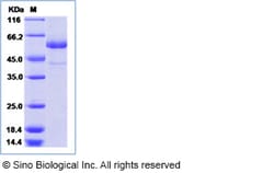 Sino Biological Recombinant Human TSHR Protein (ECD, His Tag), Quantity: