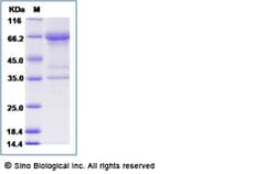Sino Biological Recombinant Human MIS/AMH Protein (His Tag), Quantity: