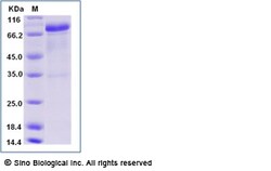 Sino Biological Human EGFR / HER1 / ErbB1 Protein (Isoform vIII, Fc Tag)