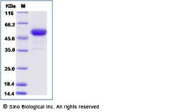 Sino Biological Human EGFR / HER1 / ErbB1 Protein (Isoform vIII, His Tag)