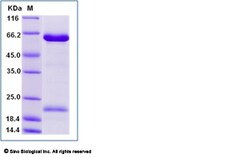 Sino Biological Human PCSK9 / NARC1 Protein (His Tag) 50ug, Quantity: Each