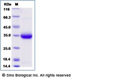 Sino Biological Human IgE-Fc Protein (His Tag) 100ug, Quantity: Each of