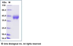 Sino Biological Human CRLF2 Protein (His Tag) 50ug, Quantity: Each of 1