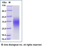 Sino Biological Recombinant Human CD79B Protein (ECD, His Tag), HPLC-verified,