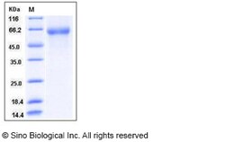 Sino Biological Influenza A H5N1 (A/Duck/Hong Kong/p46/97) Hemagglutinin