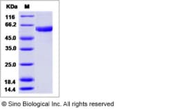 Sino Biological Influenza A H9N2 (A/duck/Hong Kong/448/78) Hemagglutinin