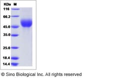 Sino Biological Influenza A H9N2 (A/duck/Hong Kong/448/78) Hemagglutinin