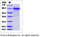 Sino Biological Influenza A H1N1 (A/England/195/2009) Hemagglutinin / HA