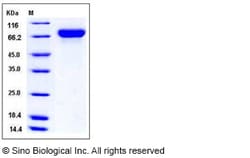 Sino Biological Influenza A H1N1 (A/Texas/05/2009) Hemagglutinin Protein