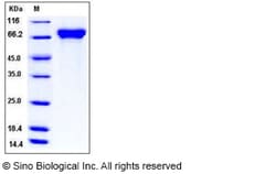 Sino Biological Influenza A H1N1 (A/Ohio/07/2009) Hemagglutinin Protein
