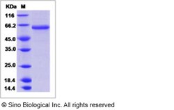 Sino Biological Influenza A H4N4 (A/mallard duck/Alberta/299/1977) Hemagglutinin